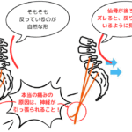 【誤解です】反り腰で下っ腹がポッコリ&腰痛の原因に？！で見落とされている《◯◯◯》
